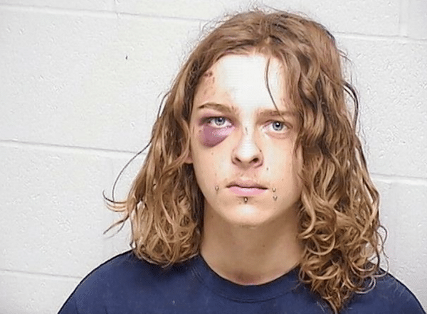 Booking-style portrait of a young person with curly reddish hair, facial piercings and a bruised eye.