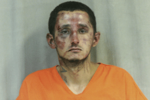 Head-and-shoulders photo of a man in an orange shirt with visible facial bruising and neck tattoos.